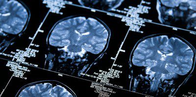 image of MRI image.