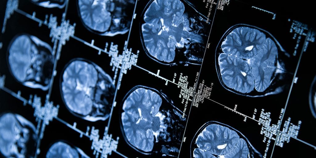 image of MRI images.