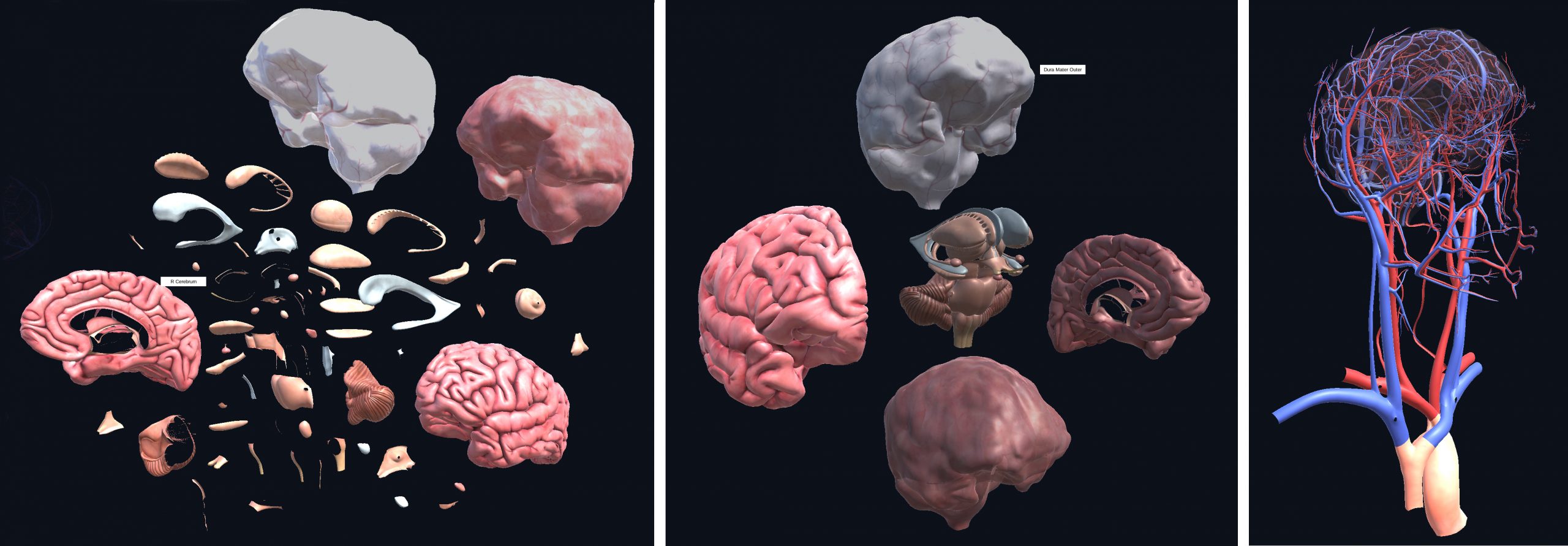 3d views of the brain