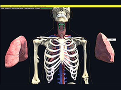 aorta_great_vessel_view2