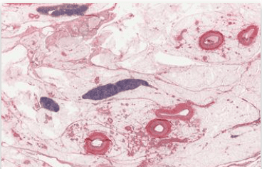 microscopic view of tissue