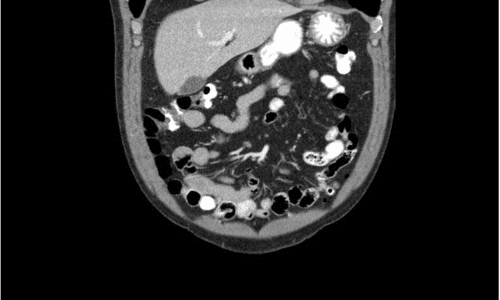 Partial view of image slider application: ultrasound of highlighted mid-section