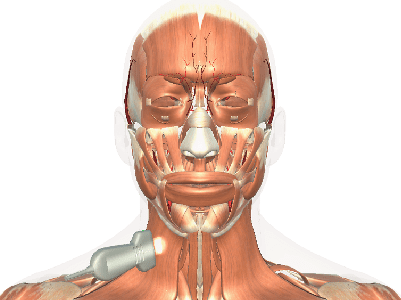 carotid_artery_view1_400