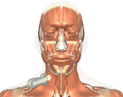 carotid_artery_view1_400