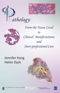Book cover for "Pathology: From the Tissue Level to Clinical Manifestations and Inter-professional Care" by Jennifer Kong and Helen Dyck. The human body, organs, and cells are depicted. Logos for UBC and BCIT are at the bottom.