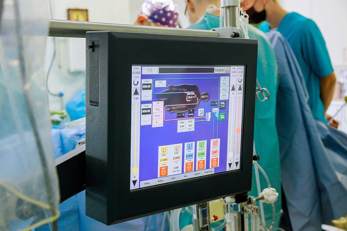 image of cardiovascular perfusion monitor screen in operating room