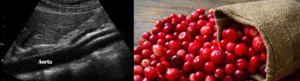 Aorta = Cranberry