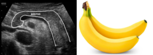 Pancreas = Banana