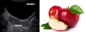 Uterus = Apple
